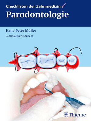 cover image of Checklisten der Zahnmedizin Parodontologie